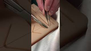 Continuous locking suture