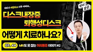 【허리】  ✔MRI도 못 잡는 허리통증?! 디스크내장증/퇴행성디스크 치료방법, 내가 알려줄게!ㅣ닥발TV