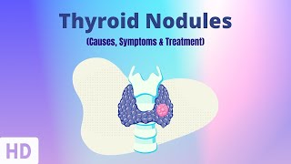 Thyroid Nodules: Causes, Symptoms and Treatment