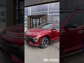 Assist Parking on 2024 Hyundai Kona