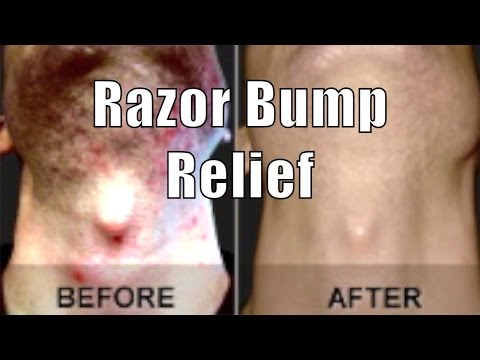 ASPIRIN RAZOR BUMP RELIEF | Cheap Tip #8 ASPIRIN RAZOR BUMP RELIEF | Cheap Tip #8