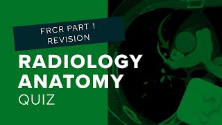 Radiology Anatomy Quiz: can you get all four cases right?