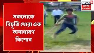 Sivasagar News | দুৰ্ঘটনাত এখন ভৰি হেৰুৱা কিশোৰে মাৰিলে নিখুঁট শ্বট