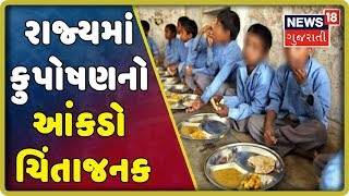 રાજ્યમાં 1,42,142 બાળકો કુપોષણનો શિકાર, દાહોદમાં સૌથી વધુ 14,191