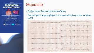 Α. Κωστοπούλου | Η Καλύτερη ή η Χειρότερη Κλινική Περίπτωση Ηλεκτροφυσιολογίας και Βηματοδοτών My...