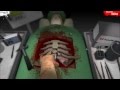 How to successfully perform a heart surgery in surgeon simulator 2013 in under 2 minutes