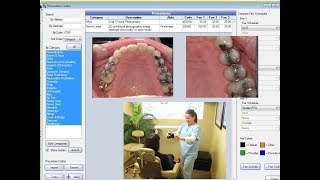 Dental Procedure Codes - Misused and Underused Codes 2018