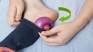 Put Onion in your socks And This will Happen