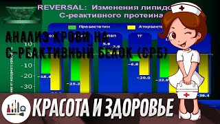 Анализ крови на С-реактивный белок (СРБ)