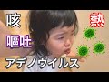 アデノウイルス感染の2歳娘！4歳息子は繰り返し嘔吐！イライラの日々を乗り越える親【2-year-old daughter with adenovirus infection】