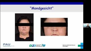 DZI-Webinar „Kortison – Freund oder Feind?“, 11.12.2024