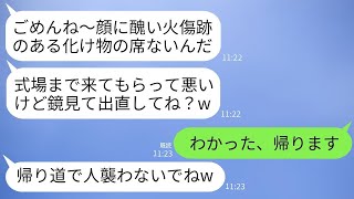 10 年前に火災で大きな顔の火傷を負った私を、義妹は結婚式の席を用意しないなど、「化け物」扱いした。