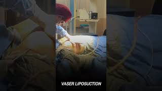 Gynecomastia Result Before and After | Rejuvena Cosmo Care in Jaipur by Dr. Deepesh Goyal