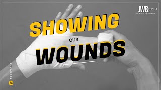 Showing Your Wounds | Sermon Replay