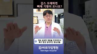 깁스 오래하면 뼈에 기형이 오나요?? #깁스 #기형