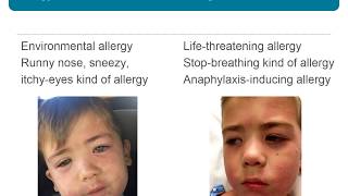 Anaphylaxis For Healthcare Providers