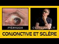 Yeux rouges, bien comprendre les différentes causes pour bien se soigner (Maladie des yeux)