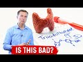 Why Fasting Lowers Your Thyroid Hormone T3 a Little Bit