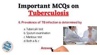 Top 10 Important Multiple Choice Questions (MCQs) on Tuberculosis (TB) for Health exams