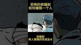 恐怖的核辐射如何摧毁一个人的？核辐射将人慢慢变成血水。#科普知识 #科普 #热点