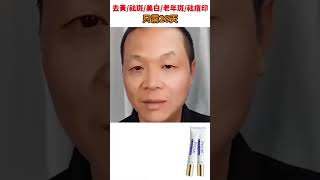 超夯美白祛斑霜 針對妊娠紋/蝴蝶紋/老人斑/雀斑/曬斑 只需28天提亮膚色 祛除色斑  無效全額退款