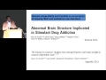 ILSI NA: EB2014 -- Obesity and the Brain (Hisam Ziauddeen, PhD)