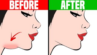How to Get Rid of a Double Chin