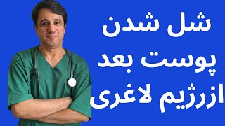 شل شدن پوست بعد از رژیم لاغری