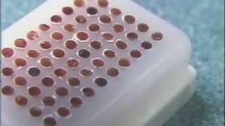 Paraffin Tissue Array Construction Using Arraymold