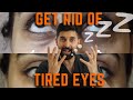 I Always Look Tired | Get rid of Tired,Dark & Puffy Eyes