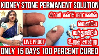 Kidney Stone Removal Permanent Solution | கிட்னி கல் 15 நாட்களில் வெளியே வந்துவிடும் | Asha Lenin