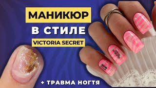 РОЗОВЫЙ маникюр в стиле Victoria Secret 💕 ТРАВМА НОГТЯ 😩 Укрепление гелем 💥