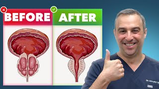 Shrink Enlarged Prostate Naturally Without Pills