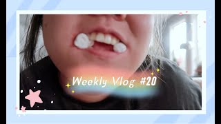 [2021王小胖和大虫哥]Weekly Vlog #20|被拔智齿笼罩的一周|大虫哥的“新发型”|普通的一天520