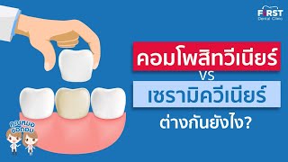 คุณหมอขอตอบ Ep3 : คอมโพสิท กับ เซรามิค วีเนียร์ ต่างกันยังไงนะ???