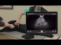 five point abdominal pocus exam