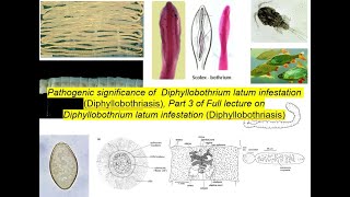 Pathogenic significance, clinical signs and diagnosis of Diphyllobothrium latum infestation