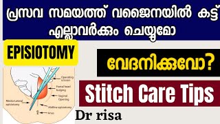 പ്രസവ സമയത്ത് വജൈന കട്ട്‌ ചെയുന്നത് എന്തിനാണ് | Episiotomy Malayalam