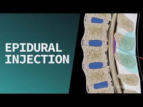 Why must medications going into the epidural space be preservative free solutions?