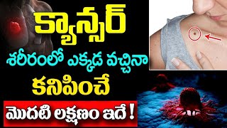 క్యాన్సర్ శరీరంలో ఎక్కడ వచ్చినా కనిపించే మొదటి లక్షణం ఇదే||Cancer Disease Symptoms In Telugu #tumore