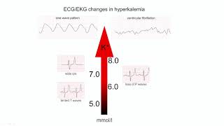 MasterKlaster2020 plenarinis pranešimas. EKG interpretacija ūmaus koronarinio sindromo atveju