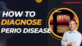 How to diagnose perio disease?