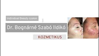 Akne hegek kezelése. Individual Beauty szalon. Dr. Bognárné Szabó Ildikó. Kozmetikus. +36 30 5293058