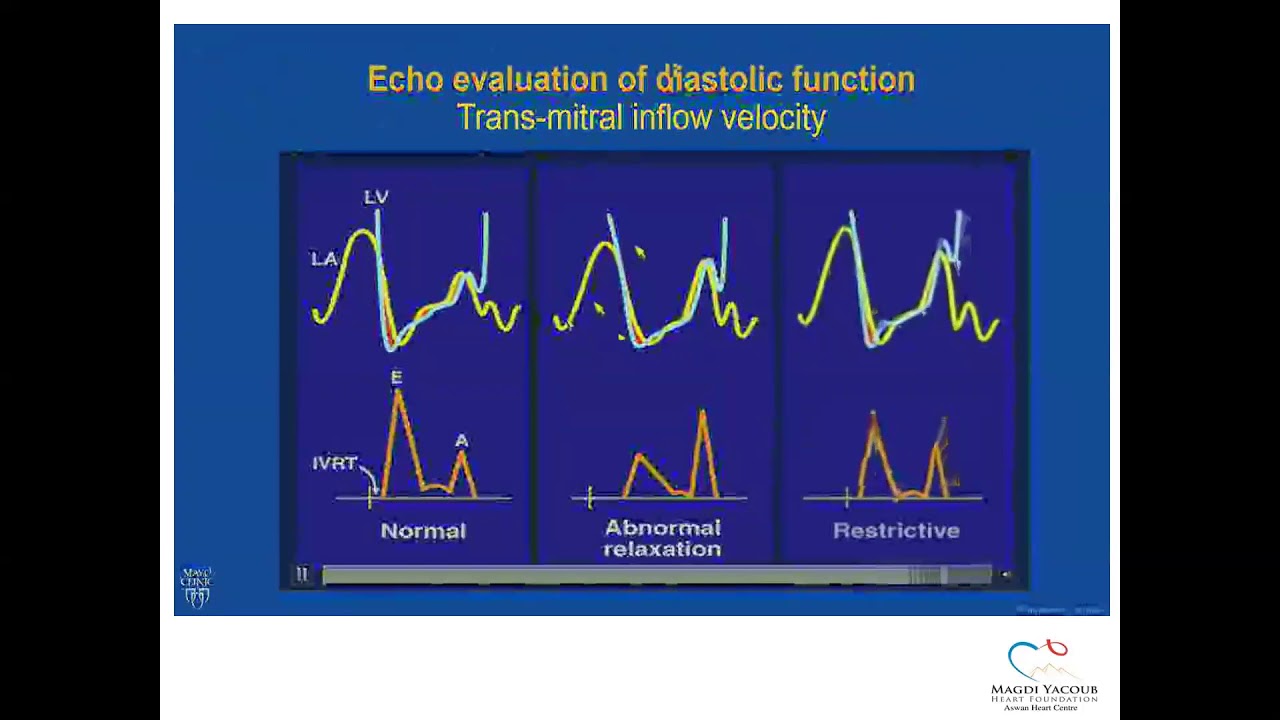 Episode 5 Diastolic Lv Function Youtube