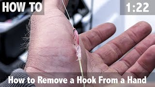 How to Remove a Hook from a Hand