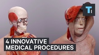 4 innovative medical procedures
