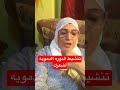 تنشيط فروة الراس مهم