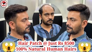 hair patch in bangalore hair fixing for men non surgical hair replacement hair fixing video