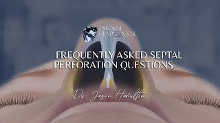 Septal Perforation: Frequently Asked Questions by Dr. Jason S. Hamilton