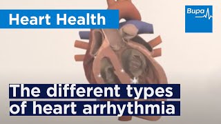 The different types of heart arrhythmia | Bupa Health